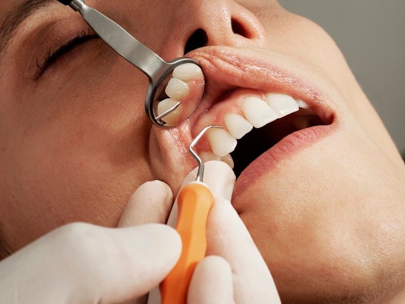 How to Help Your Child Overcome Dental Anxiety
